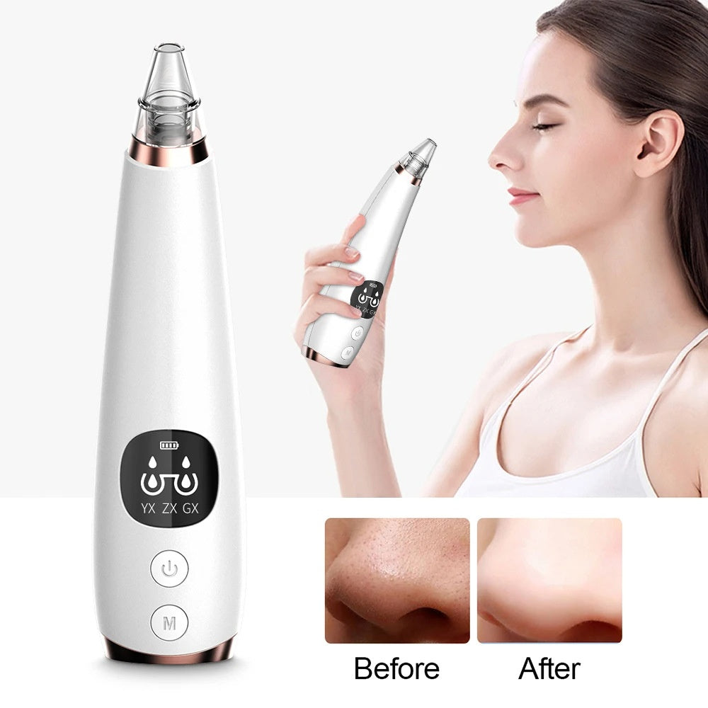 Electric Blackhead Remover – Pore Cleaning & Suction Facial Device