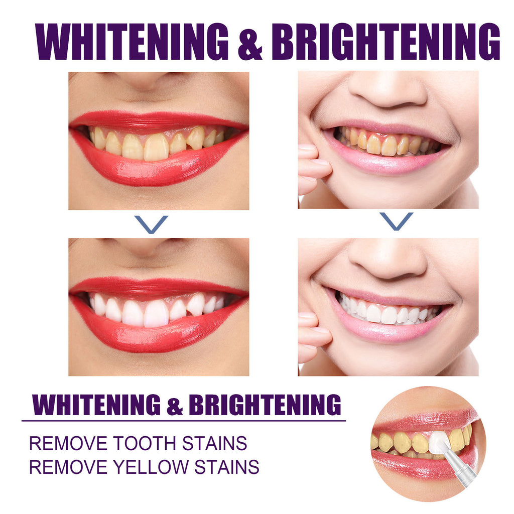 V34 Purple Teeth Whitening Pen – Stain Removal & Brightening Oral Care Dental Pen