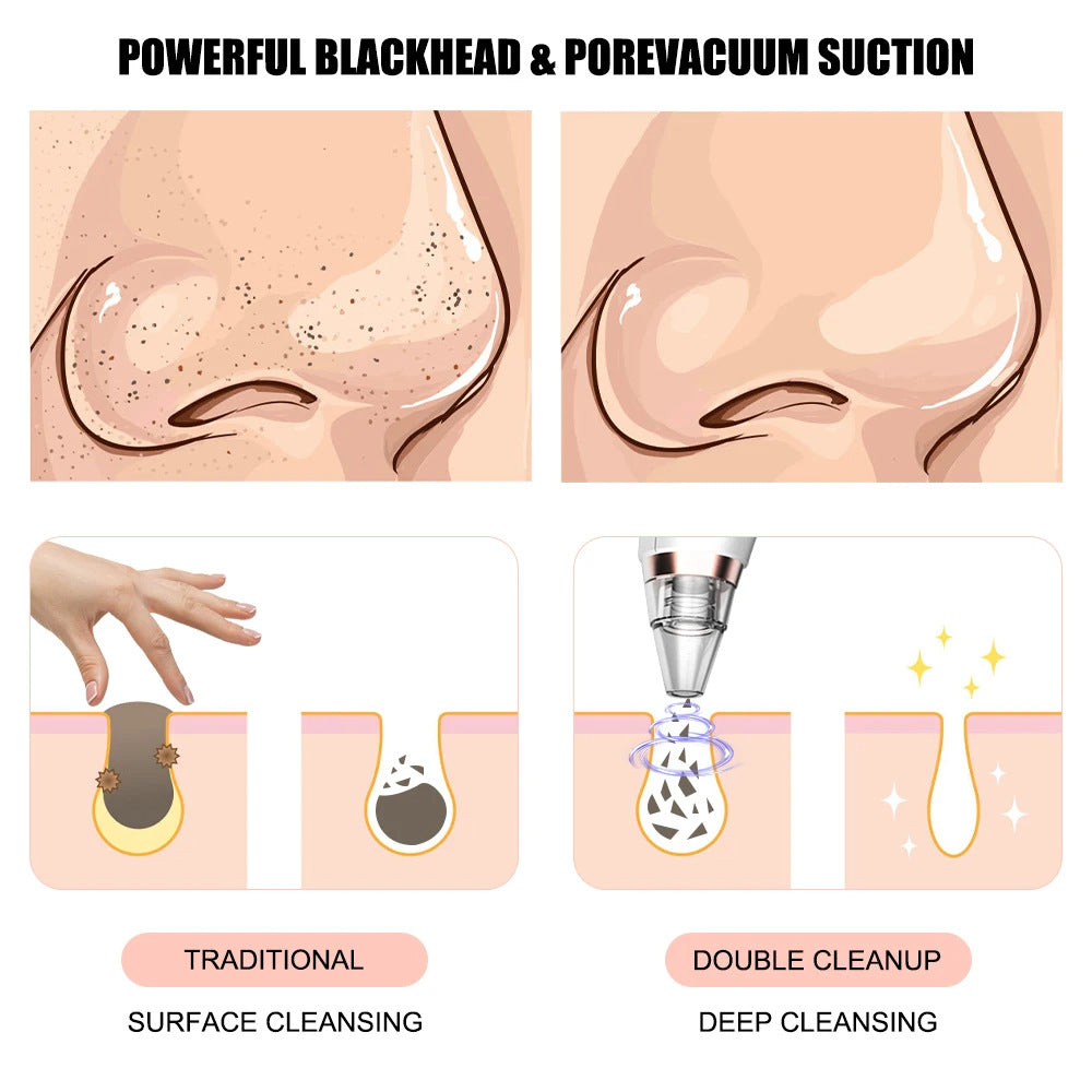 Electric Blackhead Remover – Pore Cleaning & Suction Facial Device