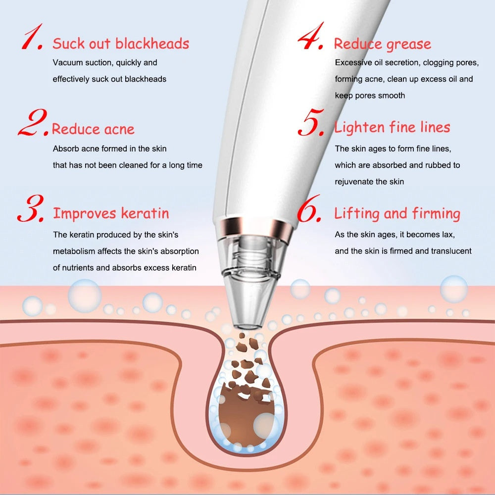 Electric Blackhead Remover – Pore Cleaning & Suction Facial Device