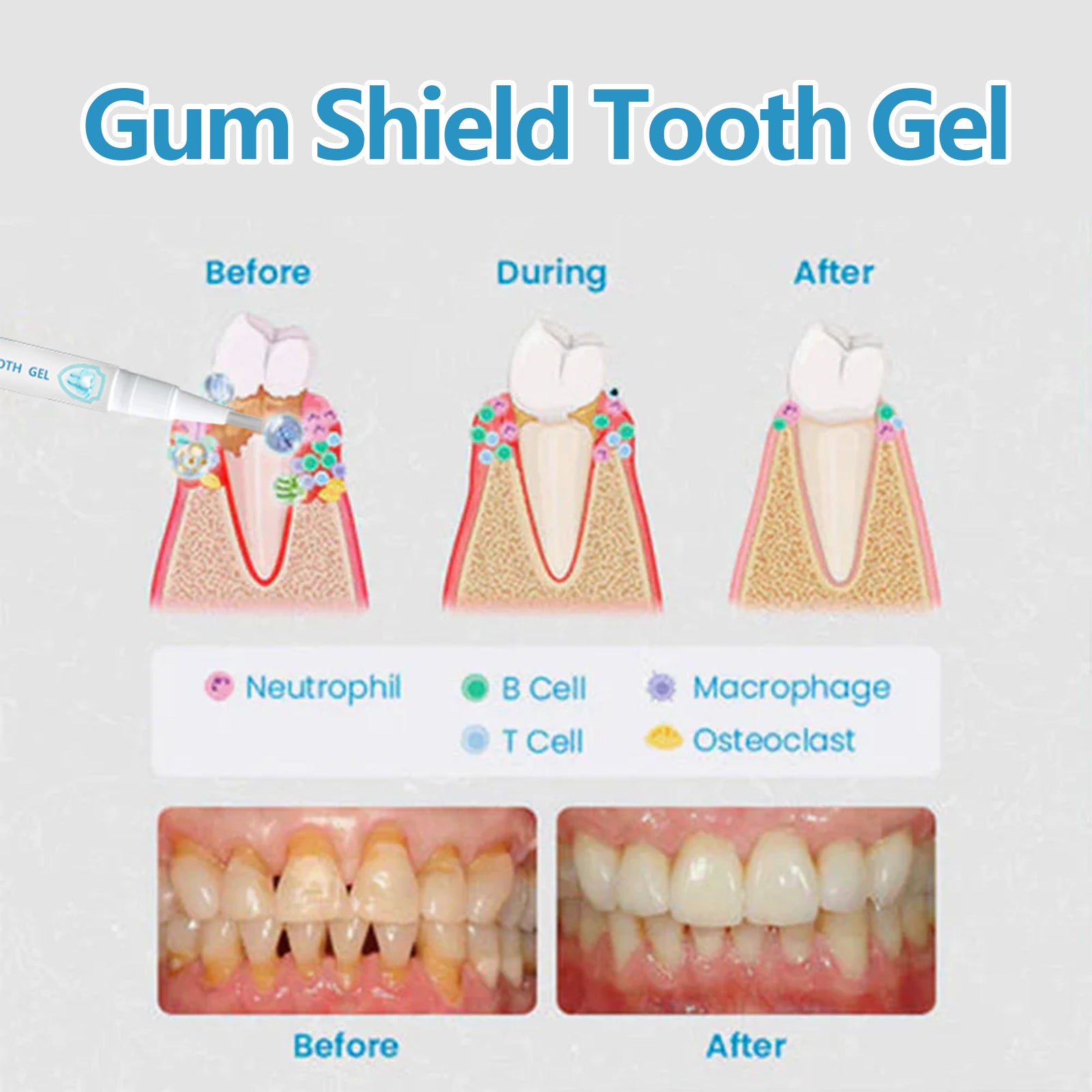 Teeth & Gum Care Gel Pen – Stain Cleaning & Gum Strength Support