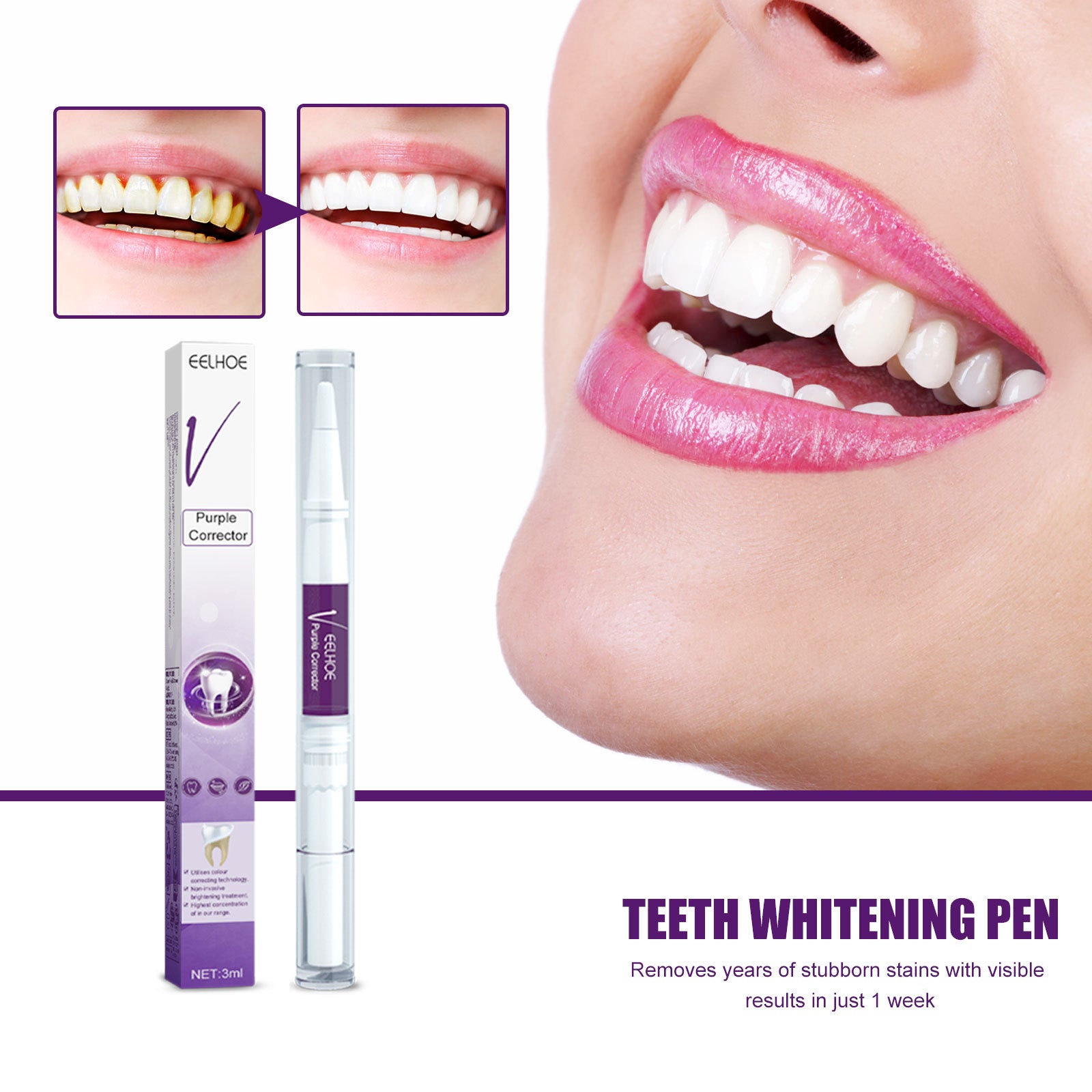 V34 Purple Teeth Whitening Pen – Stain Removal & Brightening Oral Care Dental Pen